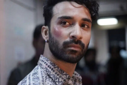 শাহরুখ খানের রাজার শুটিংয়ের সময় আহত হওয়া অভিনেতা রাঘব জুয়ালকে হত্যা করুন, এখন অবস্থা কেমন?